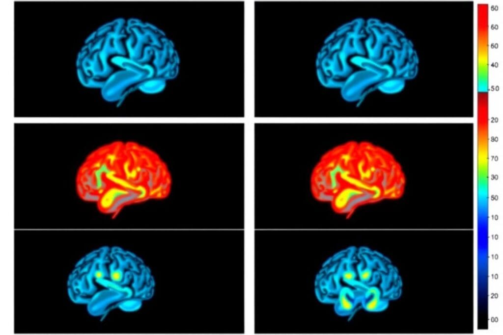 Why You Shouldn't Skip Breakfast Anymore 3 | eat move healthy Brain-function- comparison-between- breakfast-eaters-and- breakfast-skippers
